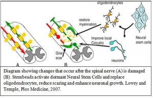 spinalbrainstrokeopticneuropathy - Neural Stem Cell Institute ...