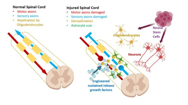 Spinal Cord Injury Program - Neural Stem Cell Institute, Rensselaer NY